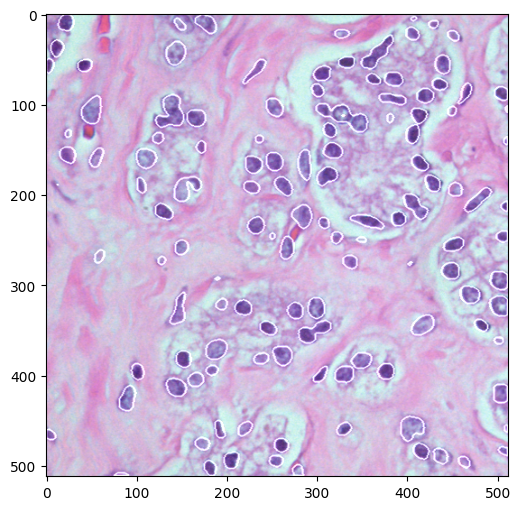 Nuclei Segmentation 2